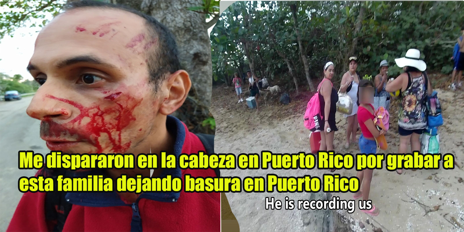 Video: Shot At The Head In Puerto Rico For Recording Family Leave Garbage